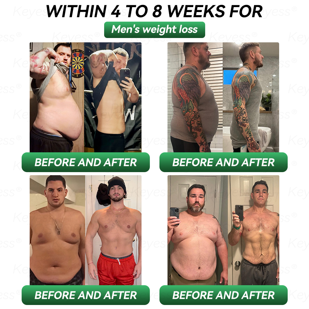 ๐๐๐๐ข๐๐ข๐๐ฅ ๐๐ญ๐จ๐ซ๐ | ๐๐๐ฒ๐๐ฌ๐ฌยฎ ๐ ๐๐๐-๐ & ๐๐๐ญ๐ซ๐ข๐ฑ๐ฒ๐ฅ ๐๐๐๐ ๐๐ฅ๐ข๐ฆ๐ฆ๐ข๐ง๐  & ๐๐๐๐ฅ๐ญ๐ก ๐๐ซ๐จ๐ฉ๐ฌโ
 For obesity, sagging skin, cardiovascular health, diabetes, sleep apnea, joint problems, etc.๐